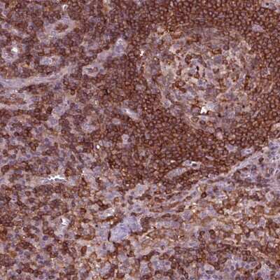 Immunohistochemistry-Paraffin: ARHGAP25 Antibody [NBP2-57228] - Immunohistochemical staining of human lymph node shows strong cytoplasmic positivity in lymphoid cells.