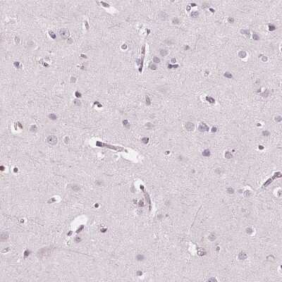 Immunohistochemistry-Paraffin: ARHGAP25 Antibody [NBP2-57228] - Staining of human cerebral cortex shows low expression as expected.