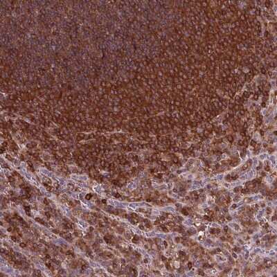 Immunohistochemistry-Paraffin: ARHGAP25 Antibody [NBP2-57228] - Staining of human spleen shows high expression.