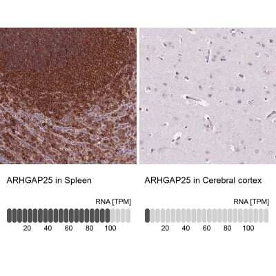 <b>Orthogonal Strategies Validation. </b>Immunohistochemistry-Paraffin: ARHGAP25 Antibody [NBP2-57228] - Staining in human spleen and cerebral cortex tissues using anti-ARHGAP25 antibody. Corresponding ARHGAP25 RNA-seq data are presented for the same tissues.