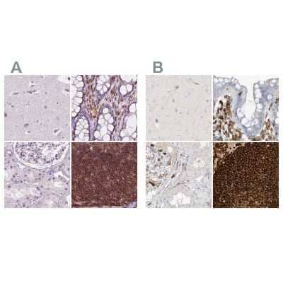 <b>Independent Antibodies Validation. </b>Immunohistochemistry-Paraffin: ARHGAP25 Antibody [NBP2-57228] - Staining of human cerebral cortex, colon, kidney and lymph node using Anti-ARHGAP25 antibody NBP2-57228 (A) shows similar protein distribution across tissues to independent antibody NBP1-83053 (B).
