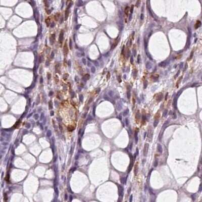 Immunohistochemistry-Paraffin: ARHGAP25 Antibody [NBP2-57228] - Staining of human colon.