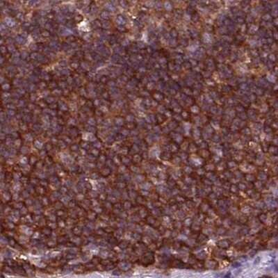 Immunohistochemistry-Paraffin: ARHGAP25 Antibody [NBP2-57228] - Staining of human lymph node.