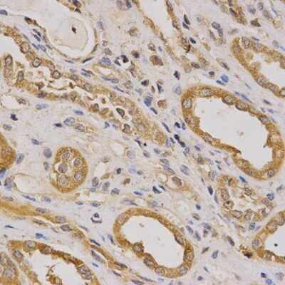 Immunohistochemistry-Paraffin: ARHGAP25 Antibody [NBP2-92851] - Paraffin-embedded human kidney using ARHGAP25 .