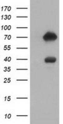 Western Blot: ARHGAP25 Antibody (OTI2D5) - Azide and BSA Free [NBP2-71508] - HEK293T cells were transfected with the pCMV6-ENTRY control (Left lane) or pCMV6-ENTRY ARHGAP25 (Right lane) cDNA for 48 hrs and lysed. Equivalent amounts of cell lysates (5 ug per lane) were separated by SDS-PAGE and immunoblotted with anti-ARHGAP25.
