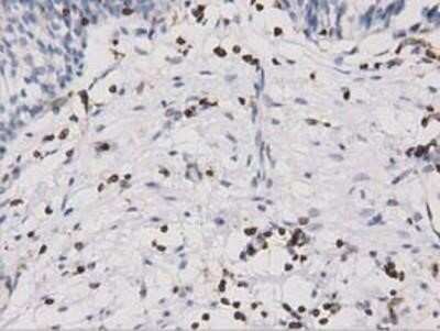 Immunohistochemistry-Paraffin: ARHGAP25 Antibody (OTI2D5) [NBP2-03024] - Staining of paraffin-embedded Human bladder tissue using anti-ARHGAP25 mouse monoclonal antibody.