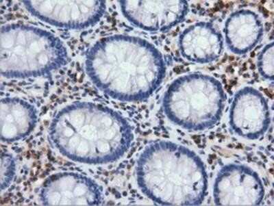 Immunohistochemistry-Paraffin: ARHGAP25 Antibody (OTI2D5) [NBP2-03024] - Staining of paraffin-embedded Human colon tissue using anti-ARHGAP25 mouse monoclonal antibody.