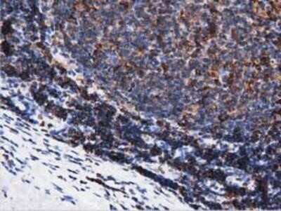 Immunohistochemistry-Paraffin: ARHGAP25 Antibody (OTI2D5) [NBP2-03024] - Staining of paraffin-embedded Human lymph node tissue using anti-ARHGAP25 mouse monoclonal antibody.