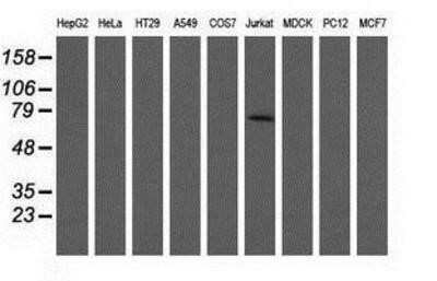 Western Blot: ARHGAP25 Antibody (OTI2D5) [NBP2-03024] - Analysis of extracts (35ug) from 9 different cell lines by using anti-ARHGAP25 monoclonal antibody.