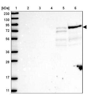 Western Blot: ARHGAP25 Antibody [NBP1-83053] - Lane 1: Marker  [kDa] 230, 130, 95, 72, 56, 36, 28, 17, 11.  Lane 2: Human cell line RT-4.  Lane 3: Human cell line U-251MG sp.  Lane 4: Human plasma (IgG/HSA depleted).  Lane 5: Human liver tissue.  Lane 6: Human tonsil tissue