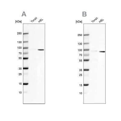 <b>Independent Antibodies Validation. </b>Western Blot: ARHGAP25 Antibody [NBP1-83053] - Analysis using Anti-ARHGAP25 antibody NBP1-83053 (A) shows similar pattern to independent antibody NBP2-57228 (B).