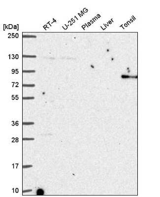 Western Blot: ARHGAP25 Antibody [NBP2-57228] - Western blot analysis in human cell line RT-4, human cell line U-251 MG, human plasma, human liver tissue and human tonsil tissue.