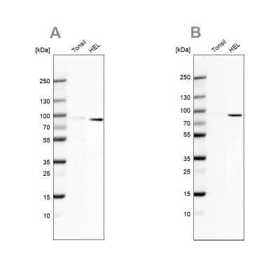 Western Blot: ARHGAP25 Antibody [NBP2-57228] - Analysis using Anti-ARHGAP25 antibody NBP2-57228 (A) shows similar pattern to independent antibody NBP1-83053 (B).