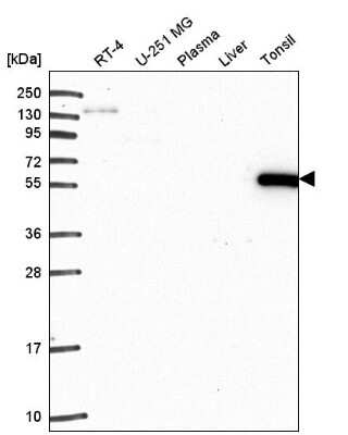 Western Blot: ARHGAP27 Antibody [NBP2-55668] - Analysis in human cell line RT-4, human cell line U-251 MG, human plasma, human liver tissue and human tonsil tissue.