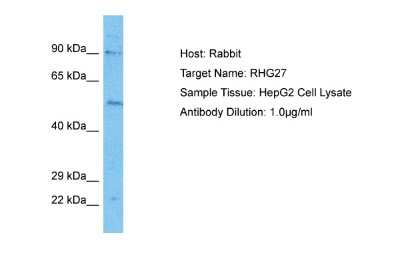 Western Blot: ARHGAP27 Antibody [NBP2-84452] - Host: Rabbit. Target Name: RHG27. Sample Type: HepG2 Whole Cell lysates. Antibody Dilution: 1ug/ml