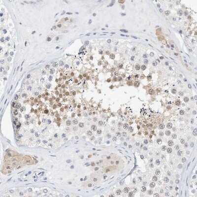 Immunohistochemistry-Paraffin: ARHGAP28 Antibody [NBP1-84641] - Staining of human testis shows moderate nuclear and cytoplasmic positivity in a subset of cells in seminiferus ducts.