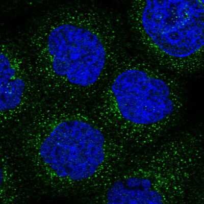 Immunocytochemistry/Immunofluorescence: ARHGAP30 Antibody [NBP1-84653] - Staining of human cell line A-431 shows localization to vesicles. Antibody staining is shown in green.