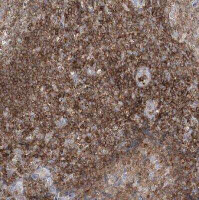 Immunohistochemistry-Paraffin: ARHGAP30 Antibody [NBP1-84653] - Staining of human tonsil shows strong cytoplasmic positivity in non-germinal center cells.