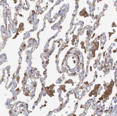 Immunohistochemistry-Paraffin: ARHGAP30 Antibody [NBP1-84653] - Staining of human lung shows moderate cytoplasmic positivity in macrophages.