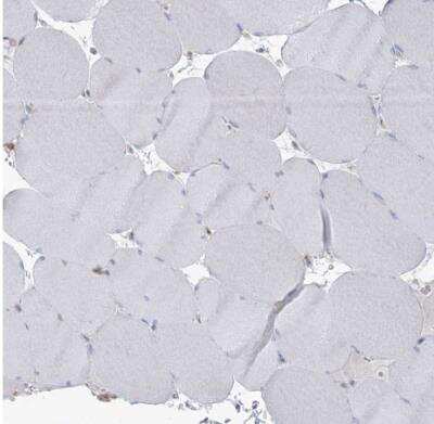 Immunohistochemistry-Paraffin: ARHGAP30 Antibody [NBP1-84653] - Staining of human skeletal muscle shows no positivity in myocytes as expected.