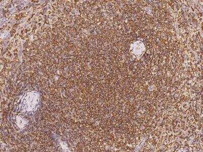 Immunohistochemistry-Paraffin: ARHGAP30 Antibody [NBP3-06084] - Immunochemical staining of human ARHGAP30 in human spleen with rabbit polyclonal antibody at 1:1000 dilution, formalin-fixed paraffin embedded sections.