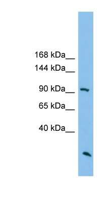 Western Blot: ARHGAP30 Antibody [NBP1-79547] - Titration: 0.2-1 ug/ml, Positive Control: HT1080 cell lysate.