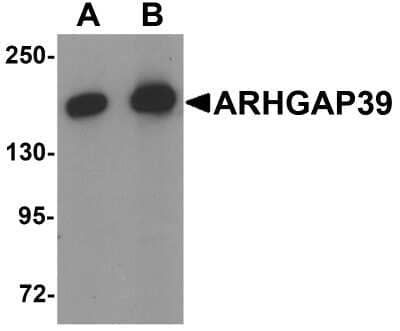 Western Blot ARHGAP39 Antibody - BSA Free