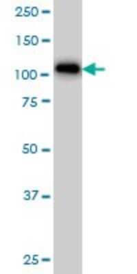 Western Blot: ARHGAP4 Antibody (3F7) [H00000393-M01] - ARHGAP4 monoclonal antibody (M01), clone 3F7 Analysis of ARHGAP4 expression in K-562.