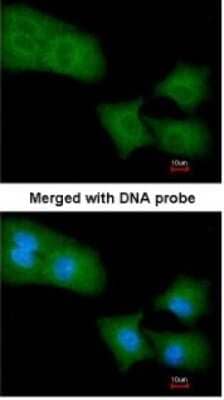 Immunocytochemistry/Immunofluorescence: ARHGAP4 Antibody [NBP1-31976] - Paraformaldehyde-fixed A549, using antibody at 1:200 dilution.