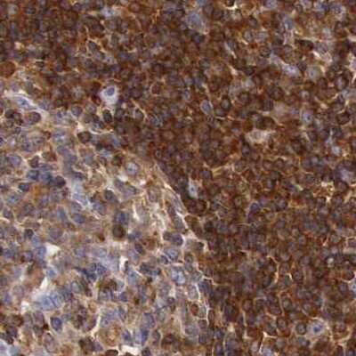 Immunohistochemistry-Paraffin: ARHGAP4 Antibody [NBP1-88527] - Staining of human lymph node.