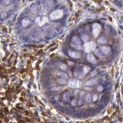 Immunohistochemistry-Paraffin: ARHGAP4 Antibody [NBP1-88527] - Staining of human colon.