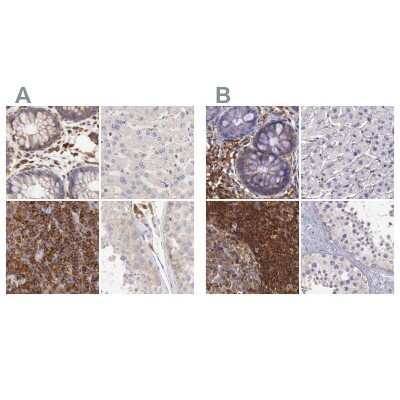 <b>Independent Antibodies Validation. </b>Immunohistochemistry-Paraffin: ARHGAP4 Antibody [NBP1-88528] - Staining of human colon, liver, lymph node and testis using Anti-ARHGAP4 antibody NBP1-88528 (A) shows similar protein distribution across tissues to independent antibody NBP1-88527 (B).