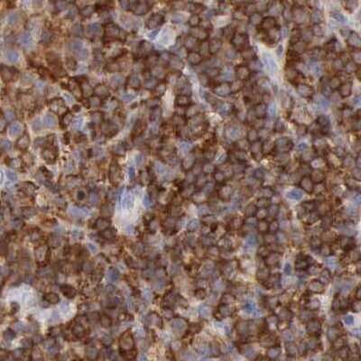 Immunohistochemistry-Paraffin: ARHGAP4 Antibody [NBP1-88528] - Staining of human lymph node.