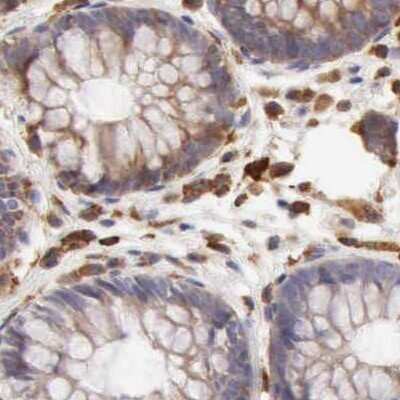 Immunohistochemistry-Paraffin: ARHGAP4 Antibody [NBP1-88528] - Staining of human colon.