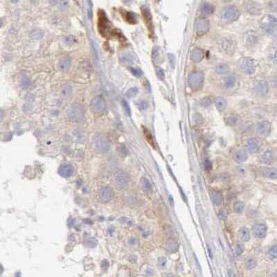 Immunohistochemistry-Paraffin: ARHGAP4 Antibody [NBP1-88528] - Staining of human testis.