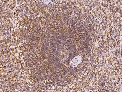 Immunohistochemistry-Paraffin: ARHGAP4 Antibody [NBP2-97915] - Immunochemical staining of human ARHGAP4 in human spleen with rabbit polyclonal antibody at 1:100 dilution, formalin-fixed paraffin embedded sections.