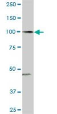 Western Blot: ARHGAP4 Antibody [H00000393-D01P] - Analysis of ARHGAP4 expression in human spleen.
