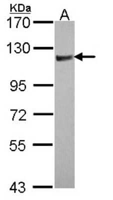 Western Blot: ARHGAP4 Antibody [NBP1-31976] - Sample (30 ug of whole cell lysate) A: JurKat 7.5% SDS PAGE; antibody diluted at 1:1000.