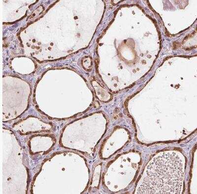 Immunohistochemistry-Paraffin ARHGAP6 Antibody