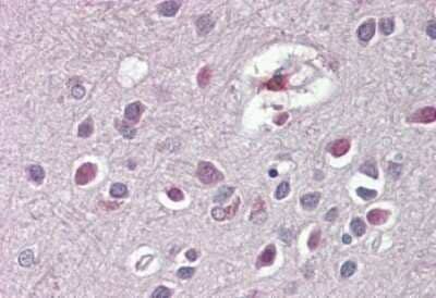 Immunohistochemistry-Paraffin ARHGDIG Antibody