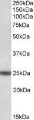 Western Blot ARHGDIG Antibody