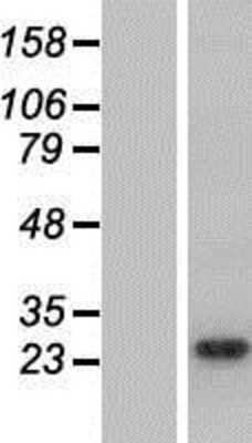 Western Blot: ARHGDIG Overexpression Lysate (Adult Normal) [NBP2-08228] Left-Empty vector transfected control cell lysate (HEK293 cell lysate); Right -Over-expression Lysate for ARHGDIG.
