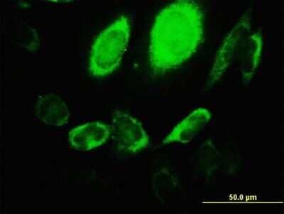 Immunocytochemistry/Immunofluorescence: ARHGEF1 Antibody (4C4) [H00009138-M03] - Analysis of monoclonal antibody to ARHGEF1 on HeLa cell. Antibody concentration 10 ug/ml