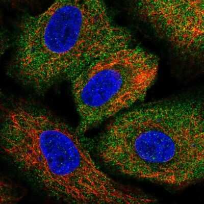 Immunocytochemistry/Immunofluorescence: ARHGEF1 Antibody [NBP2-56320] - Staining of human cell line A549 shows localization to cytosol.