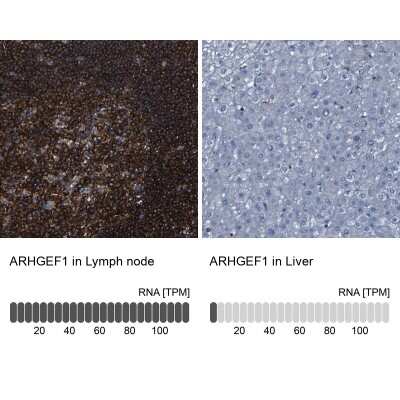 Immunohistochemistry-Paraffin: ARHGEF1 Antibody [NBP1-82843] - Analysis in human lymph node and liver tissues using NBP1-82843 antibody. Corresponding ARHGEF1 RNA-seq data are presented for the same tissues.