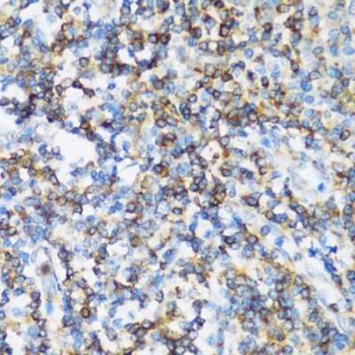 Immunohistochemistry-Paraffin: ARHGEF1 Antibody [NBP2-92963] - Human tonsil using ARHGEF1 antibody at dilution of 1:100 (40x lens).