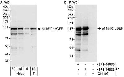 Immunoprecipitation: ARHGEF1 Antibody [NBP1-46830] - Samples: Whole cell lysate from HeLa (5, 15 and 50 ug for WB; 1 mg for IP, 20% of IP loaded) and 293T (T; 50 ug) cells. Antibodies: Affinity purified rabbit anti-p115-RhoGEF antibody used for WB at 0.04 ug/ml (A) and 0.4 ug/ml (B) and used for IP at 3 ug/mg lysate. p115-RhoGEF was also immunoprecipitated by rabbit anti-p115-RhoGEF antibody, which recognizes a downstream epitope. Detection: Chemiluminescence with exposure times of 10 seconds (A) and 3 seconds (B).