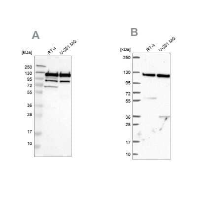 Western Blot: ARHGEF1 Antibody [NBP1-82843] - Analysis using Anti-ARHGEF1 antibody NBP1-82843 (A) shows similar pattern to independent antibody NBP2-56320 (B).