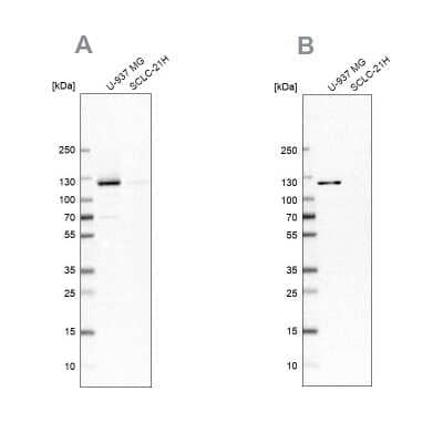 Western Blot: ARHGEF1 Antibody [NBP1-82843] - Analysis using Anti-ARHGEF1 antibody NBP1-82843 (A) shows similar pattern to independent antibody NBP2-56320 (B).