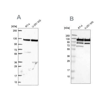 Western Blot: ARHGEF1 Antibody [NBP2-56320] - Analysis using Anti-ARHGEF1 antibody NBP2-56320 (A) shows similar pattern to independent antibody NBP1-82843 (B).